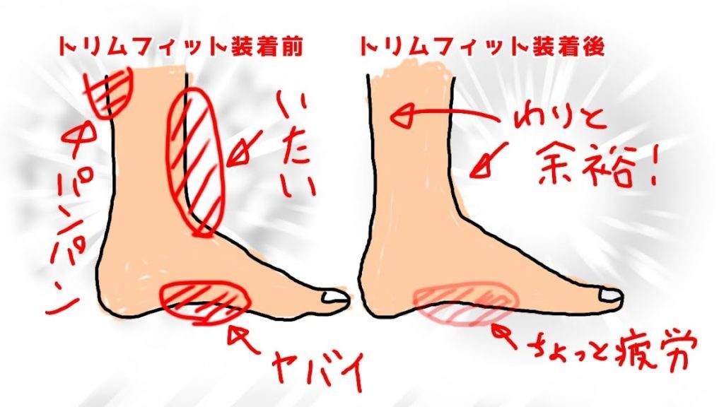 痛みの違いの図
